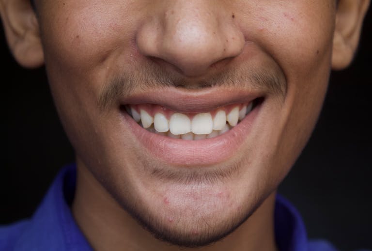 A detailed close-up of a young man's smile showcasing dental health and happiness.