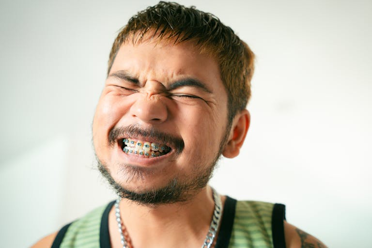 Close-up of a smiling man with braces, beard, and mustache expressing joy indoors.