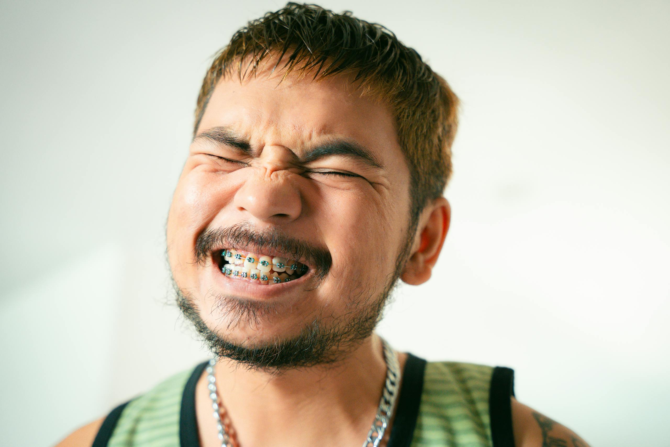 Close-up of a smiling man with braces, beard, and mustache expressing joy indoors.